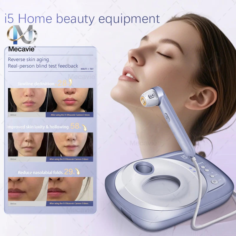 i5 Ultrasonic Cannon lifts your face from the inside out creating a youthful firmer face lifted contours restored elasticity.