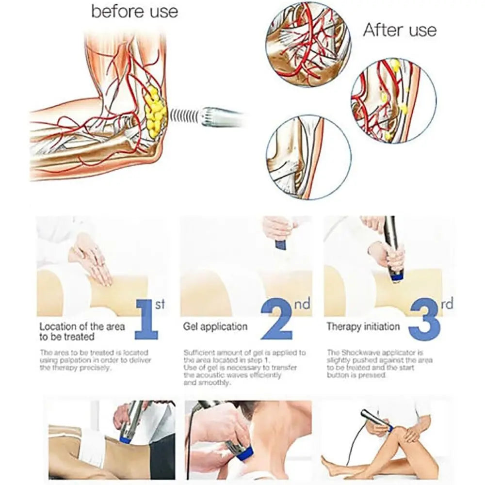 Deep Tissue Percussion Massager for Back, Shoulder, and Body Pain Relief - Electric Chiropractic Adjustment Tool